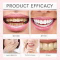 Oralhoe - Nicotinamide Dazzle White Toothpaste